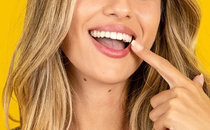 Invisalign